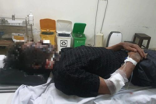 Hai người đàn ông bị sét đánh trúng khi đi bắt cá trong đêm