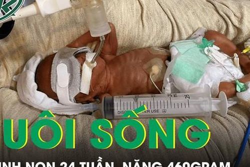 Kỳ tích nuôi sống bé sinh non 24 tuần tuổi, nặng 460 gram