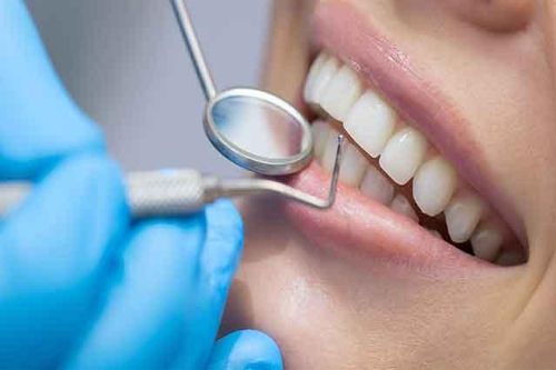 Lưu ý trước và sau khi dán sứ veneer