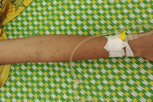 Trẻ tử vong vì người nhà rạch dao lam chi chít trên người để chữa bệnh