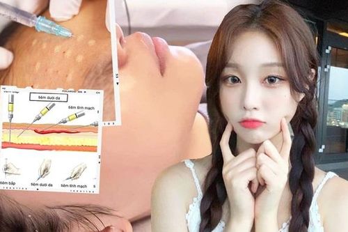 Bác sĩ da liễu lý giải vì sao tiêm meso 'gây sốt' trong thẩm mỹ nội khoa