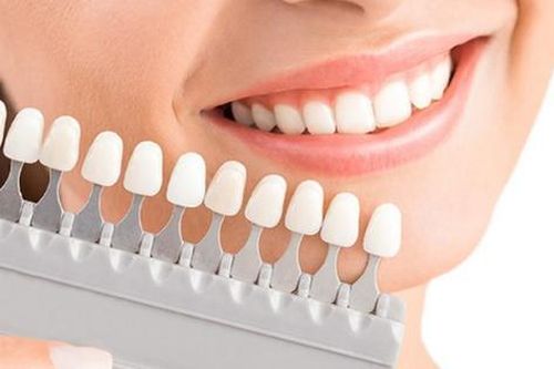 Hiểm họa khôn lường khi bọc răng sứ giá rẻ
