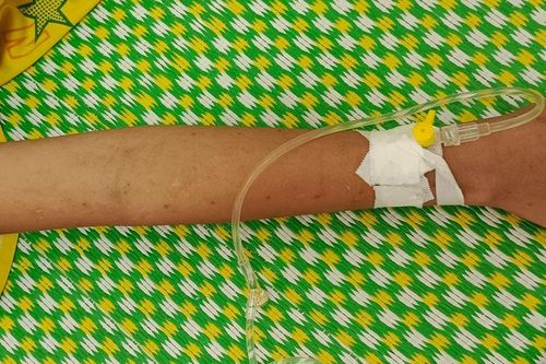 Trẻ sốt cao, người nhà dùng dao lam rạch lên người để chữa bệnh