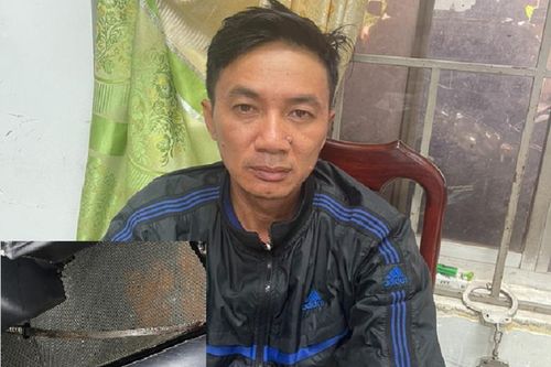 Bắt nghi phạm chém lìa chân vợ cũ