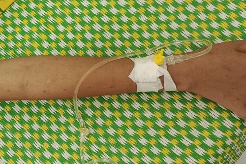 Cảnh báo nguy hiểm khi dùng dao lam chữa bệnh cho trẻ