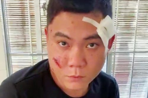 Khởi tố kẻ bắn trọng thương bố người tình
