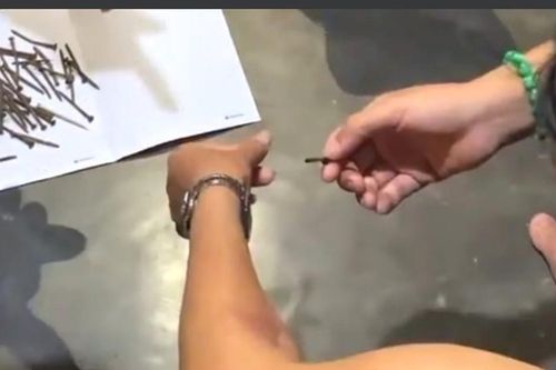 Xôn xao chuyện đinh mọc ra từ cánh tay của người phụ nữ
