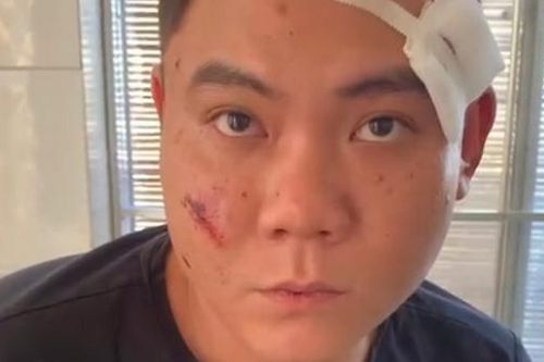 Khởi tố kẻ nổ súng bắn cha ruột của người tình