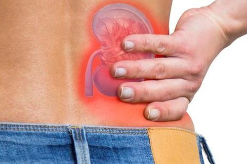 2 năm tự chữa sỏi thận bằng thuốc nam người bệnh hỏng thận