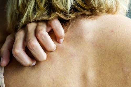 Xuất hiện 4 dấu hiệu này trên da để chắc chắn nên kiểm tra ung thư