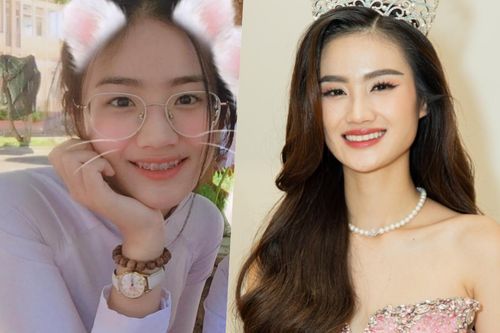Hoa hậu Ý Nhi thăng hạng nhan sắc nhờ niềng răng