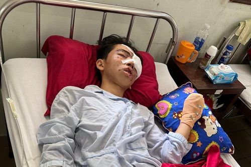 Bạn đọc báo GD&TĐ sẻ chia với hoàn cảnh 'nam sinh bị dập tay, hỏng mắt'