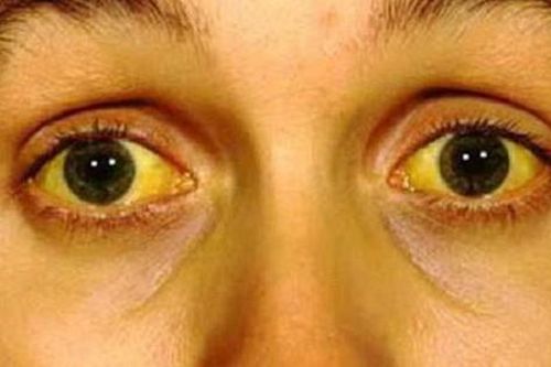 Nhiễm xoắn khuẩn Leptospira khi đi chơi thác nước: Dấu hiệu nhận biết và cách phòng tránh