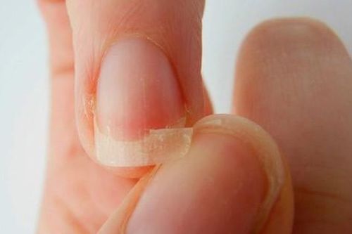 Sơn móng tay nhiều có gây hại không?