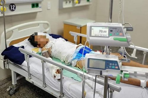 Trèo cột điện cao thế bắt chim, thiếu niên bỏng nặng, đa chấn thương