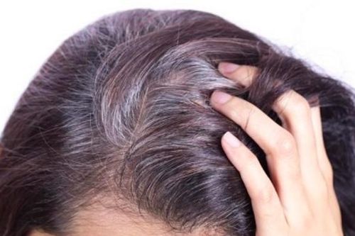 Có nên nhổ tóc bạc?