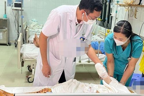Đa chấn thương, mù mắt vì điện thoại phát nổ
