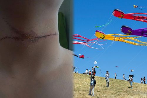 Dây diều chém đứt vỏ ô tô, cứa cổ người đi đường: Chủ diều có thể bị phạt tù