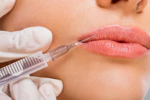 4 nguyên nhân dẫn đến biến chứng khi tiêm filler làm đẹp