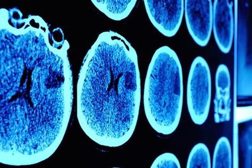 Ứng dụng AI giúp nâng cao hiệu quả sàng lọc loại ung thư phổ biến ở nữ giới