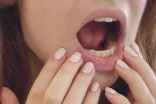 Thường xuyên khô miệng cảnh báo bệnh gì?