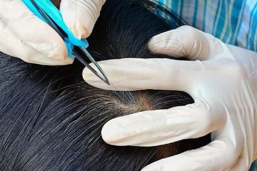 Thấy tóc bạc cũng chớ nên nhổ, đây là lý do
