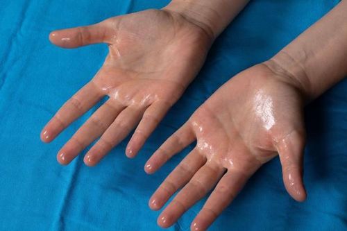 Mùa hè, cơ thể ra nhiều mồ hôi có phải là thải độc tốt hơn hay không?