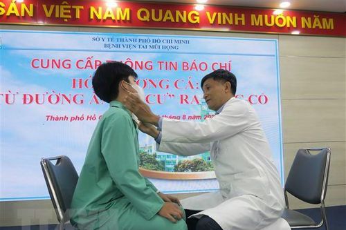 Cảnh giác khi bị hóc: Dị vật có thể 'di cư' ra vùng cổ gây nguy hiểm