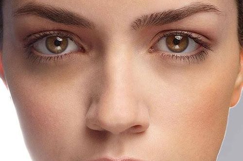 Làm thế nào để chữa vết quầng thâm mắt?