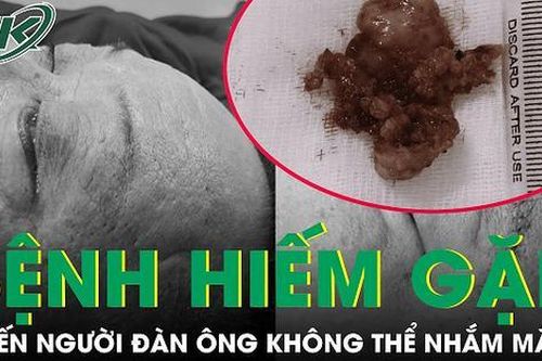 Không thể nhắm mắt vì căn bệnh hiếm gặp