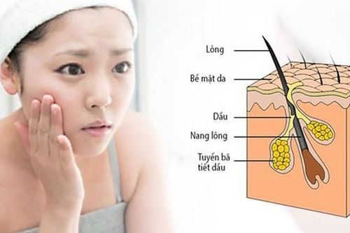 6 nguyên nhân gây da nhờn và cách khắc phục tại nhà