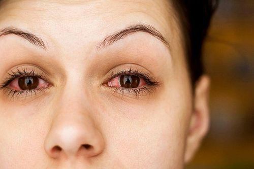 Cảnh giác với một số bệnh lý nguy hiểm về mắt ở thai phụ