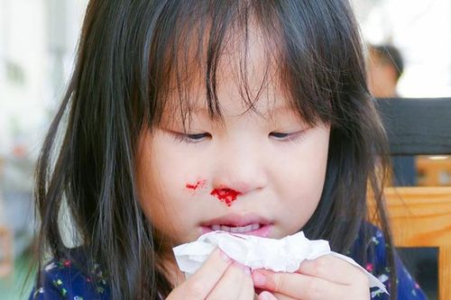 Bé trai 3 tuổi nguy kịch do bà nội xử lý chảy máu cam sai cách