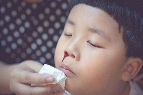 Bà nội suýt hại tính mạng cháu trai 3 tuổi khi xử lý chảy máu cam