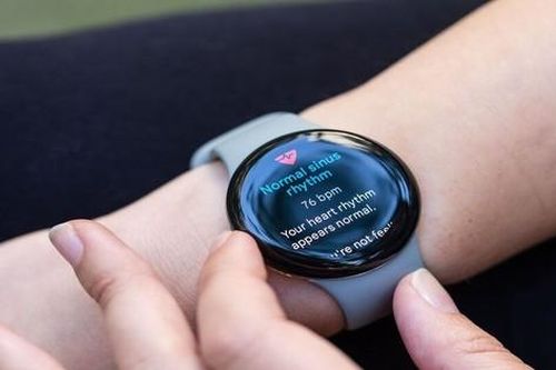 Nghi vấn nhà Táo sắp ra mắt Apple Watch X, liệu có liên quan gì đến Elon Musk?
