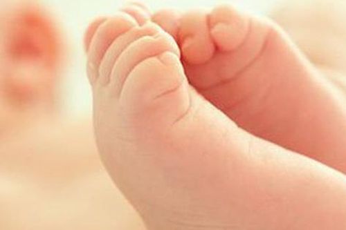 Bé gái có 24 ngón tay chân, dính ngón, bác sĩ chỉ rõ nguyên nhân