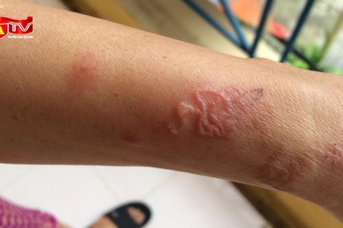 Những bệnh nguy hiểm dễ mắc vì ăn uống cùng thú cưng