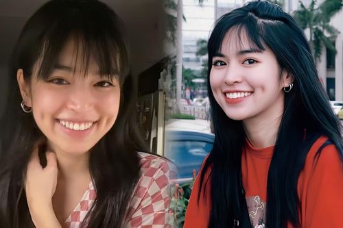 Khánh Vân 'Mắt Biếc' chi hơn 100 triệu cho việc chỉnh nha