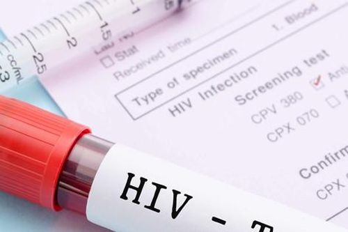 Mờ mắt, tổn thương não vì giấu bị nhiễm HIV suốt 10 năm