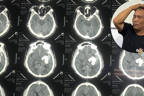 Thông tin về vụ nghi phạm đi cấp cứu sau khi bị tạm giữ tại Công an Đồ Sơn