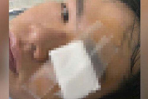 Công an mời thanh niên nghi bị CSGT dùng gậy 'tác động' lên làm việc