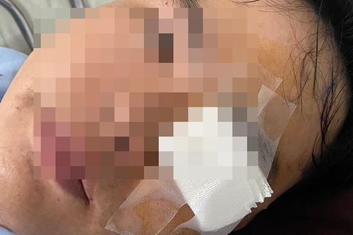 Mời làm việc với thanh niên 'tố' chấn thương mắt vì gậy của CSGT