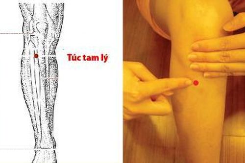 Bấm huyệt hỗ trợ điều trị bệnh trĩ