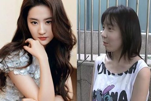Phẫu thuật giống 'thần tiên tỷ tỷ' Lưu Diệc Phi, cô gái sốc nặng