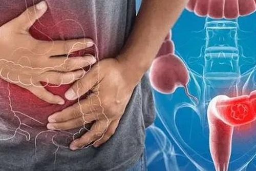 6 cách giúp ngăn ngừa ung thư đại trực tràng
