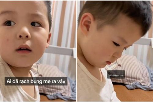 Biết nguyên nhân của vết sẹo trên bụng mẹ, cậu bé 3 tuổi nói một câu đầy ấm áp