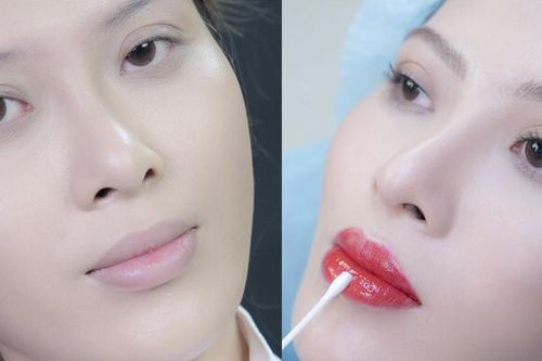 Phun xăm môi khi nào cần dặm lại?