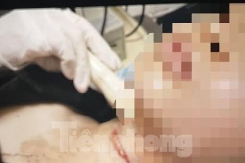 Xử phạt cô gái hoang báo bị cứa cổ cướp của