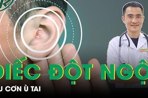 Điếc đột ngột sau cơn ù tai