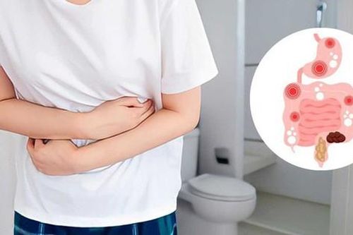 Các giải pháp hạn chế hội chứng ruột kích thích